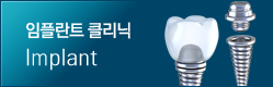 임플란트 클리닉