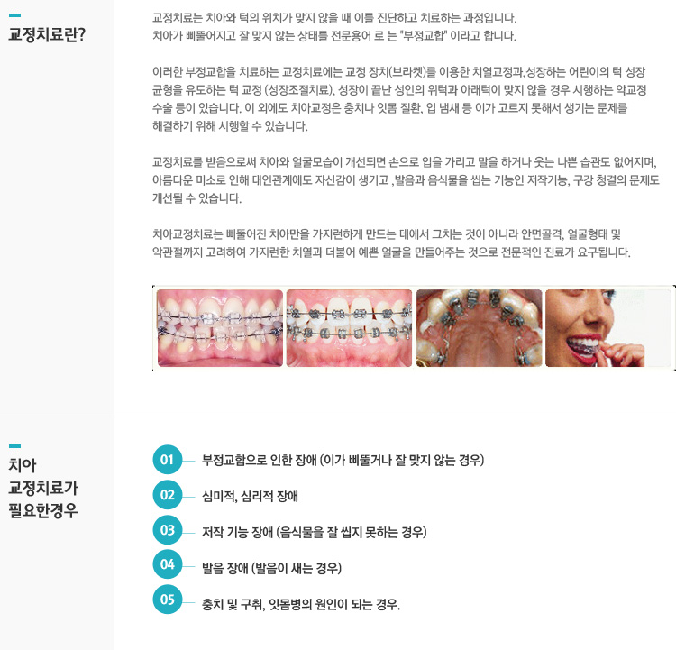 교정치료란?
