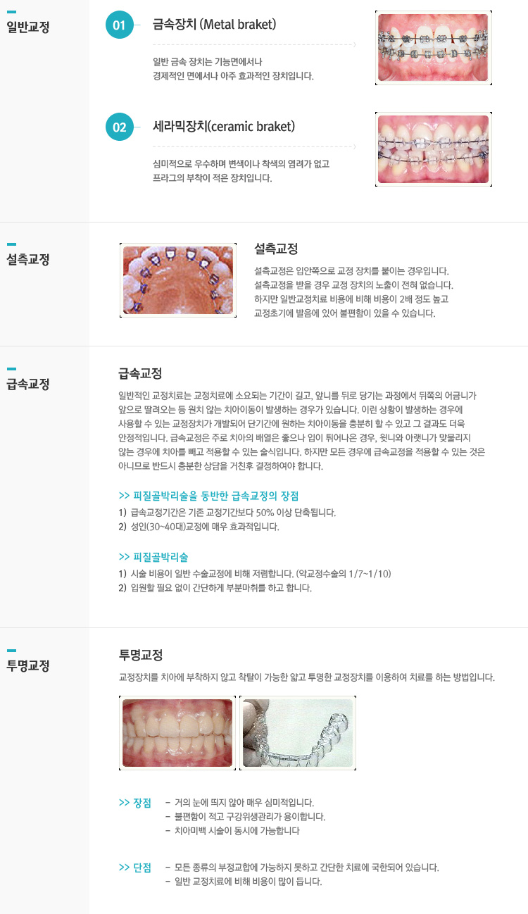 교정치료의종류