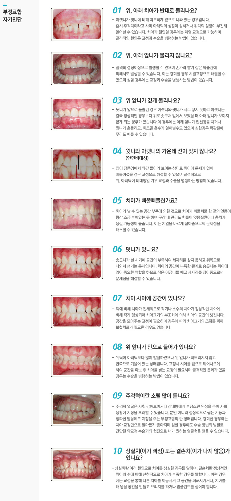 부정교합자가진단